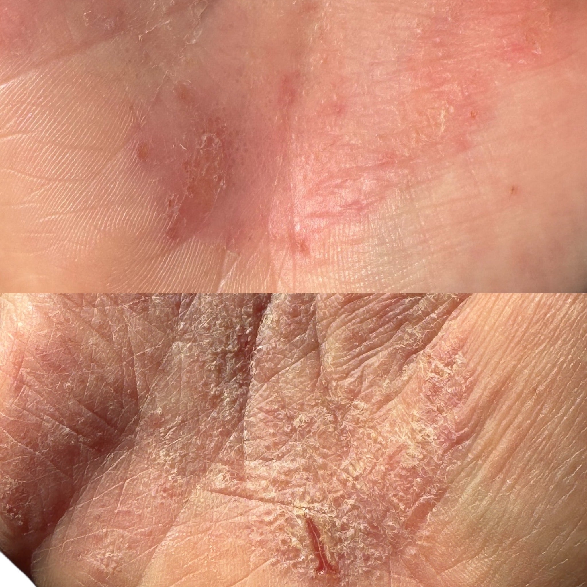 URTEHAGEN ansiktsbalm