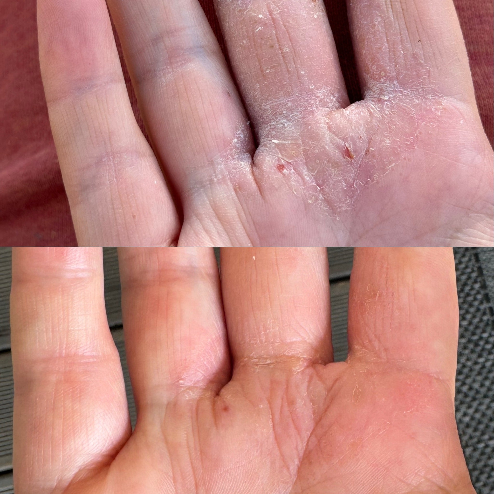 URTEHAGEN ansiktsbalm